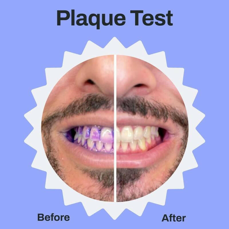 Autobrush Sonic Pro Toothbrush